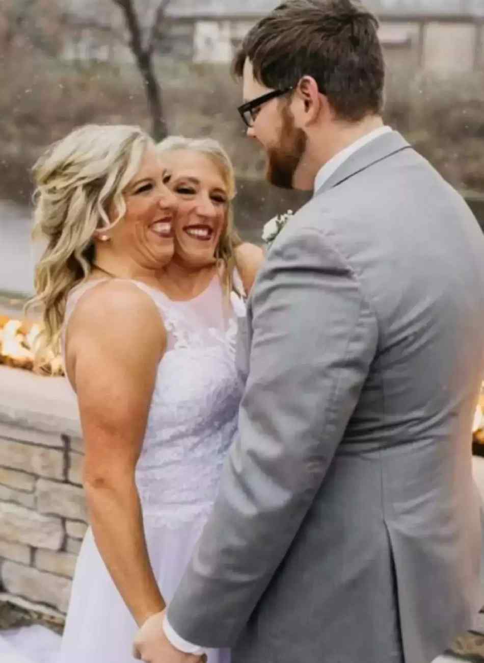 Abby Hensels Secret Wedding Details Revealed