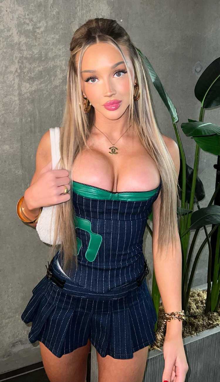 Vanna Einerson before and after