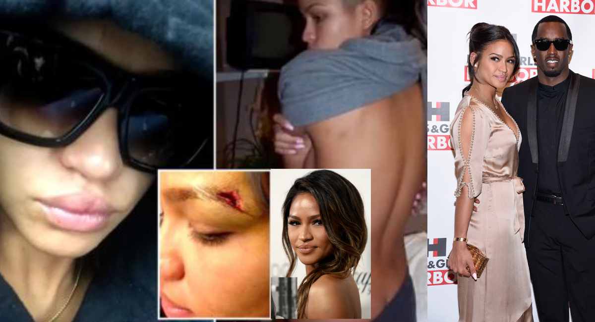 Jurors Shown Graphic Photos of Cassie Ventura’s Injuries
