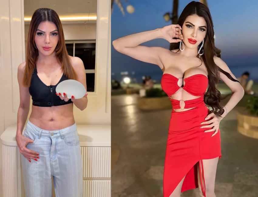 Sherlyn Chopra Removes Breast Implants After Health Issues